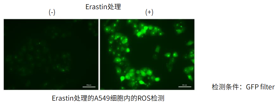 活性氧检测试剂盒（ROS Assay Kit）货号：R252